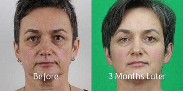 Neck Lymphatic Detox Patch