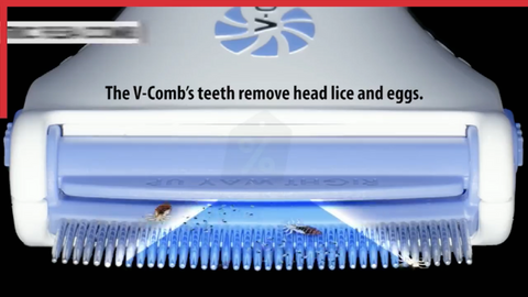 Image of Electric head comb Remove the flea louse - SlickDecor.com