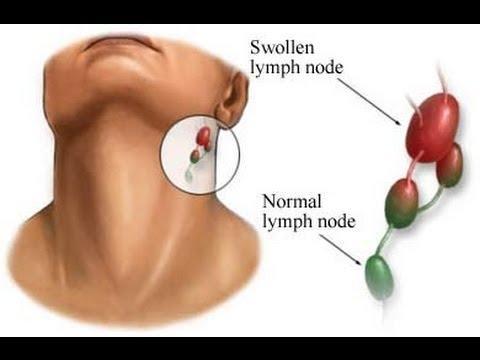 Image of Neck Lymphatic Detox Patch