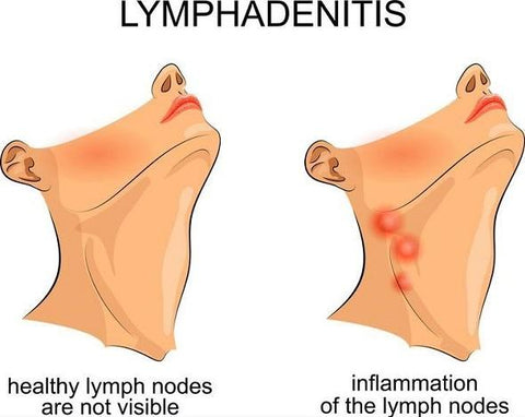 Image of Neck Lymphatic Detox Patch