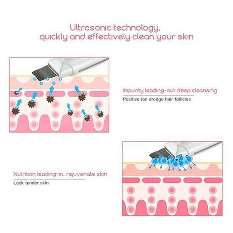 Image of Ultrasonic Skin Scrubber